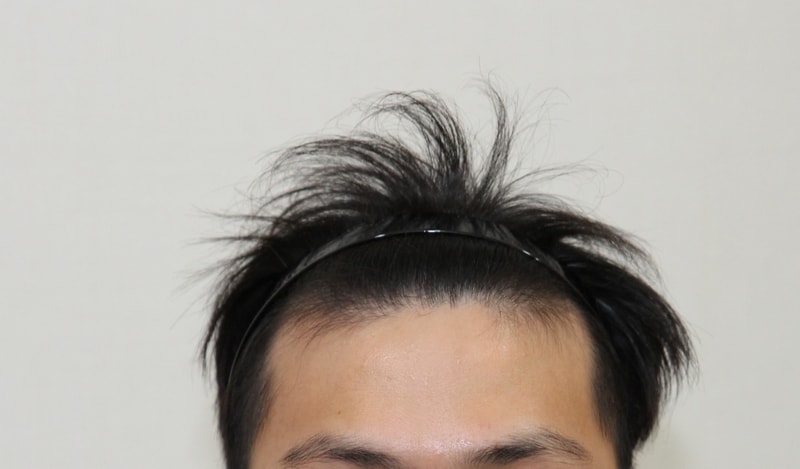 전 (1).JPG