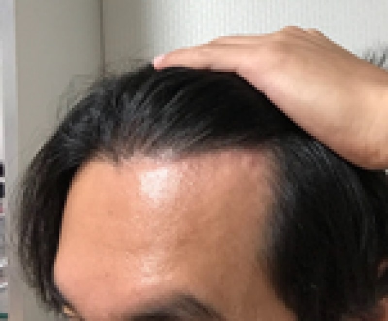 후 (2).png