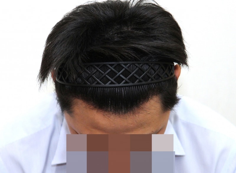 후1.jpg