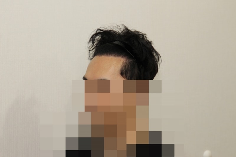 후 (2).JPG