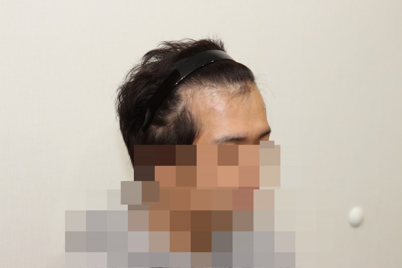 1년후 (3).JPG