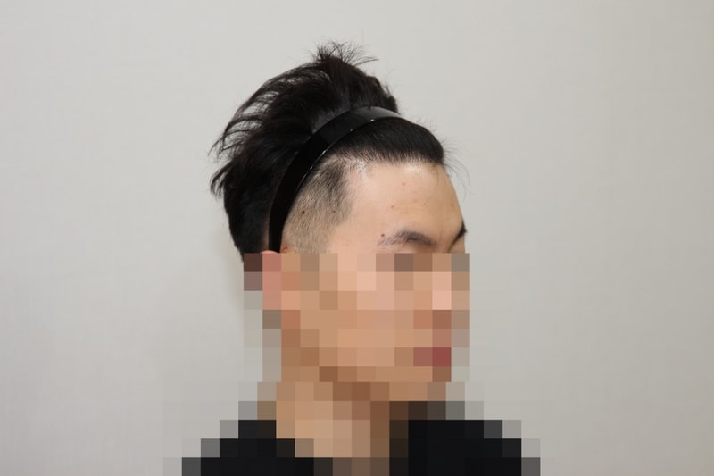 후 (3).JPG