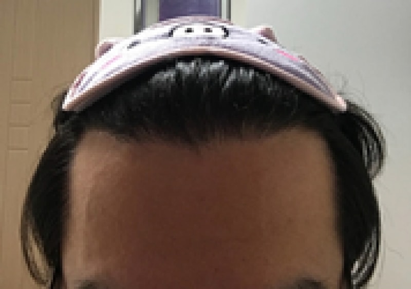 후 (3).png
