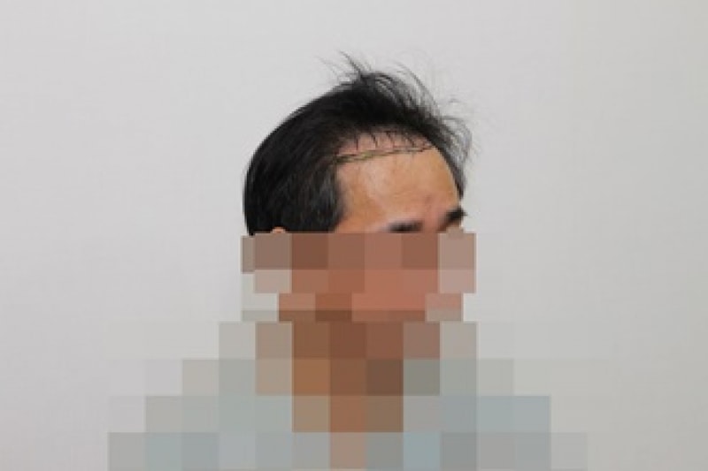전 (3).JPG