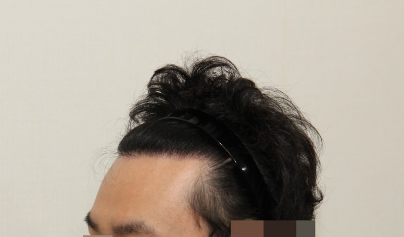 후 (2).JPG