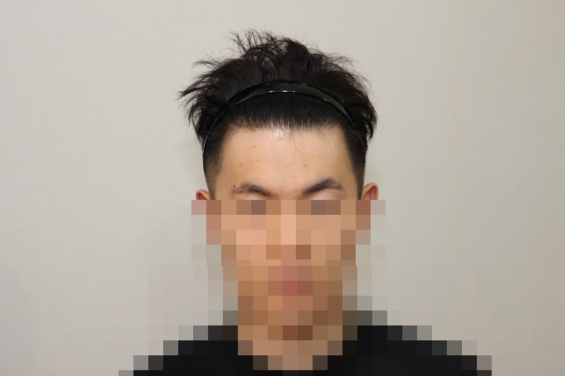 후 (1).JPG