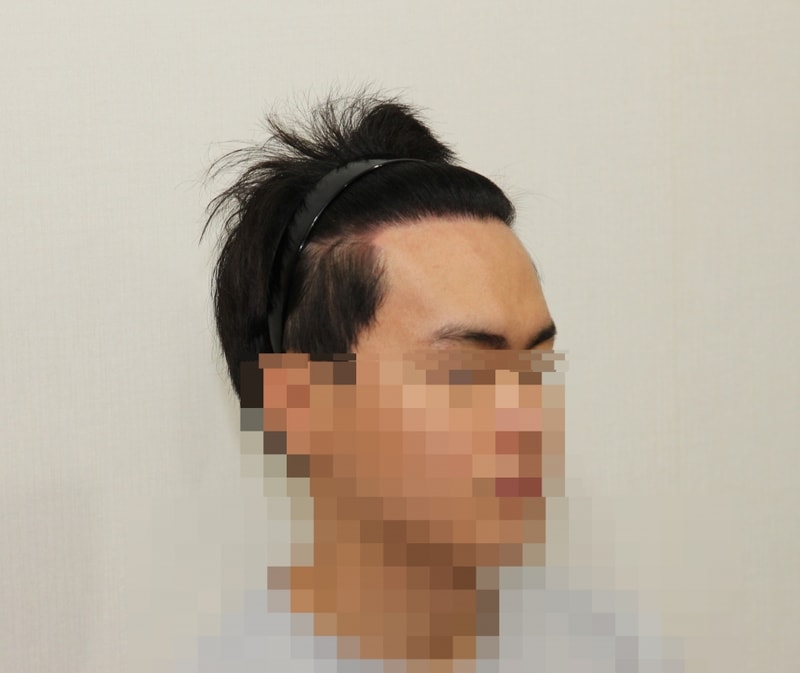 후 (1).jpg