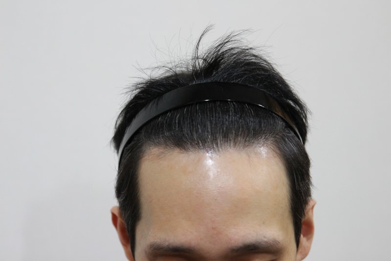 1차 후.JPG