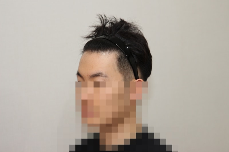 후 (2).JPG