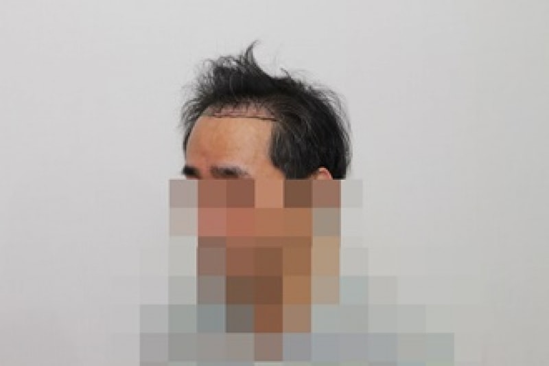 전 (2).JPG