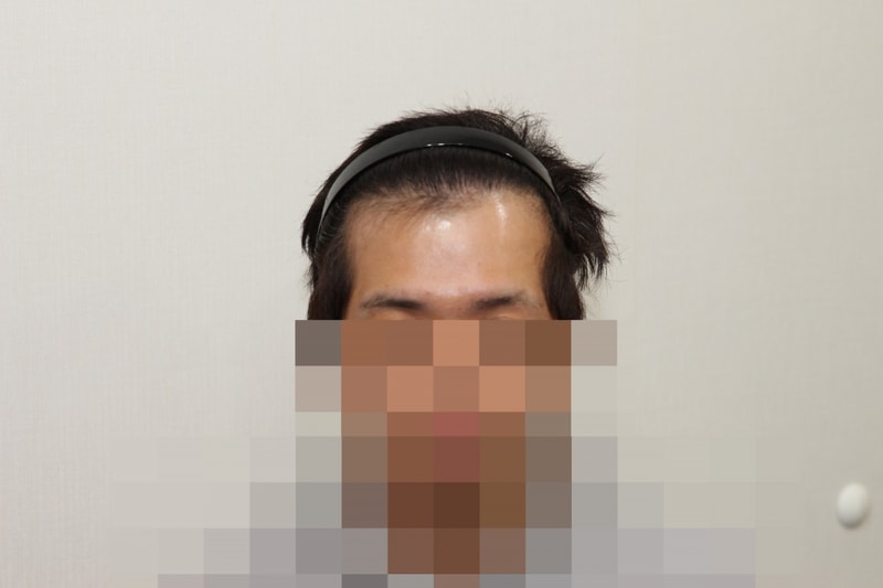 1년후 (1).JPG