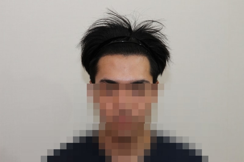 후 (1)_p.jpg