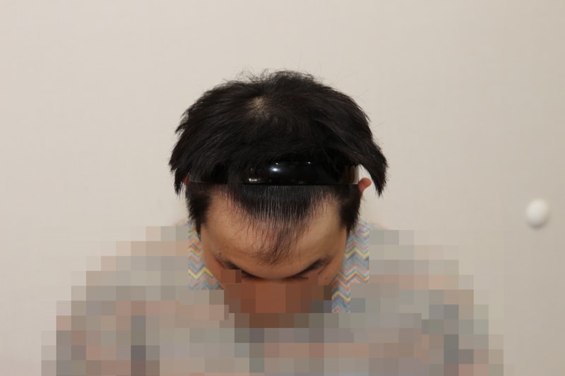 전 (1).JPG