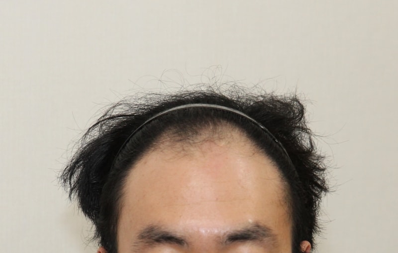 전1.JPG