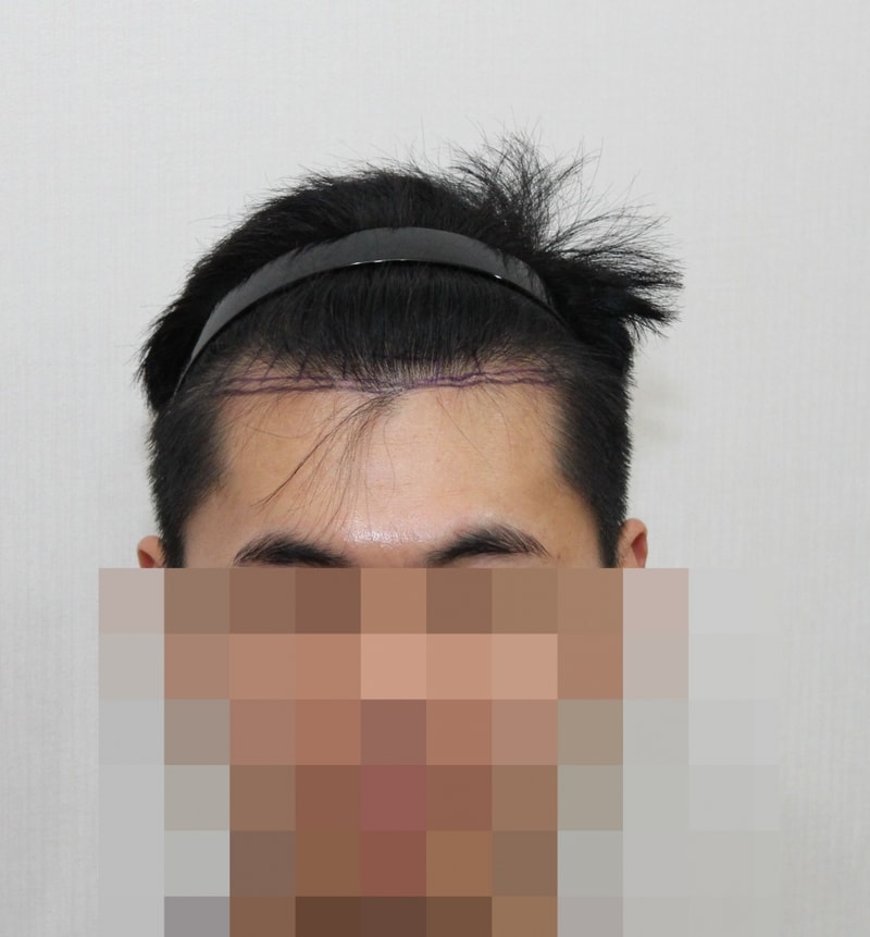 전 (1).JPG