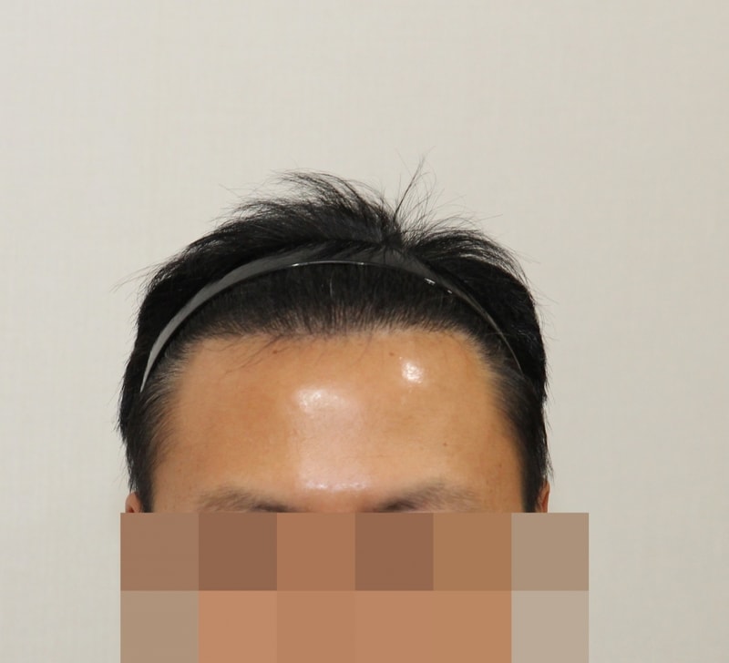 후 (1).JPG