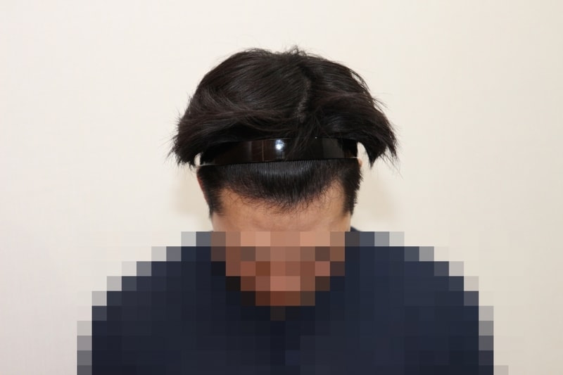 후 (4)_p.jpg