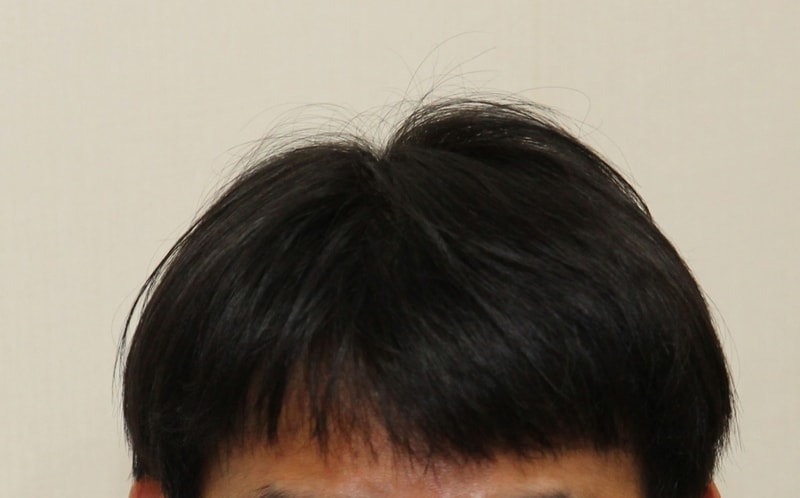 20180522 수술후.jpg