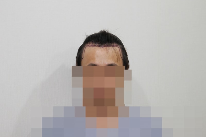 전 (3).JPG