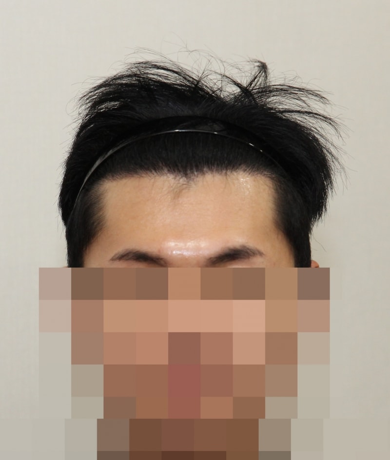후 (1).JPG