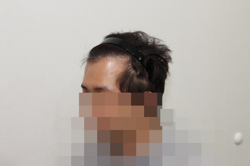 1년후 (2).JPG
