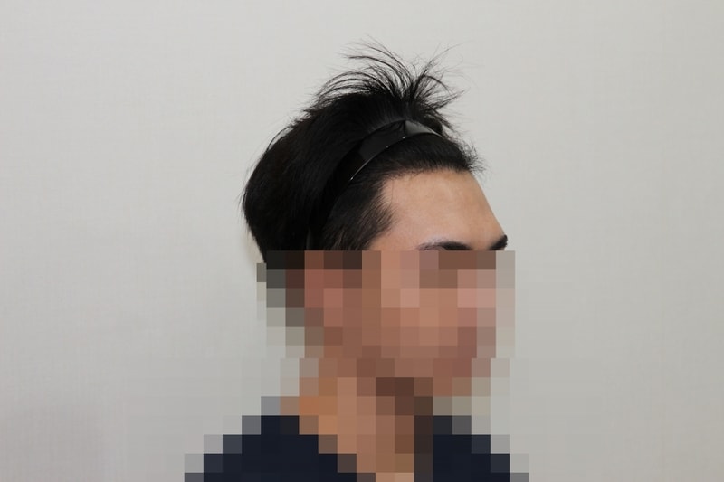 후 (3)_p.jpg