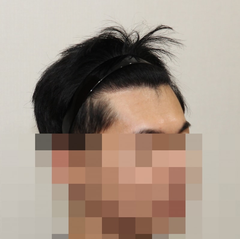 후 (3).JPG