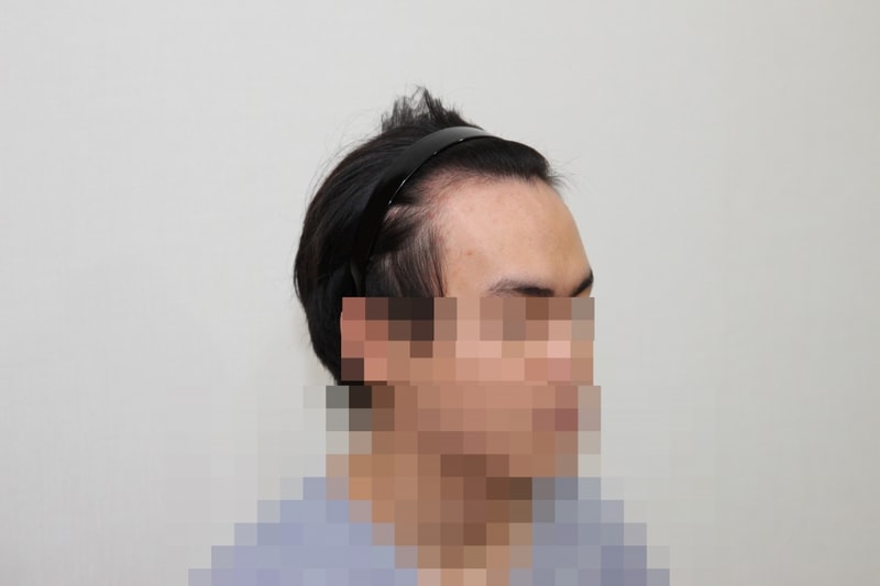 전 (1).JPG