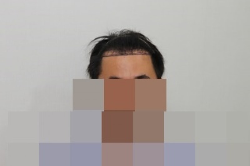 전 (1).JPG