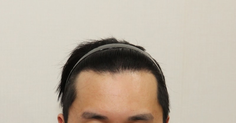 후 (1).JPG