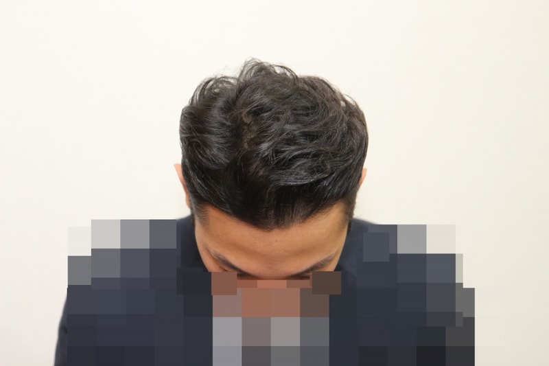 후 (1)_p.jpg