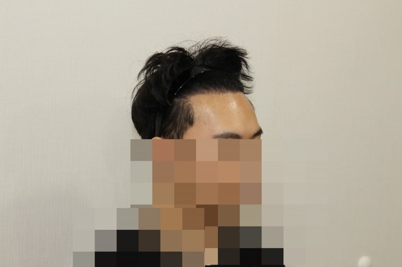 후 (3).JPG