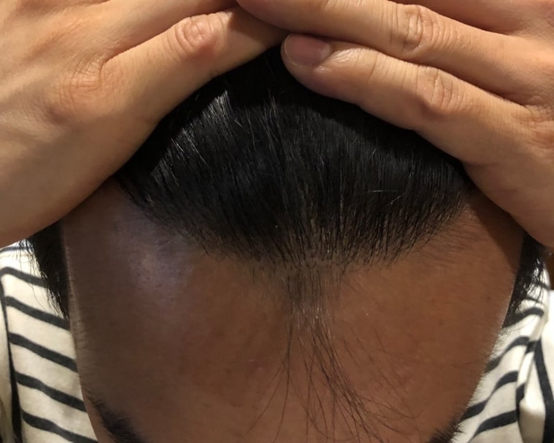 20180522 수술후2.jpg