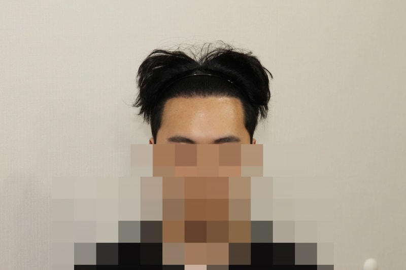 후 (1).JPG