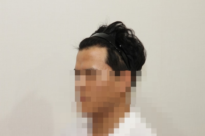 후2.JPG