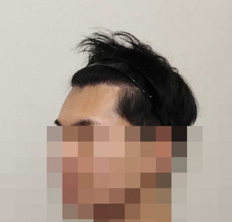 후 (2).JPG