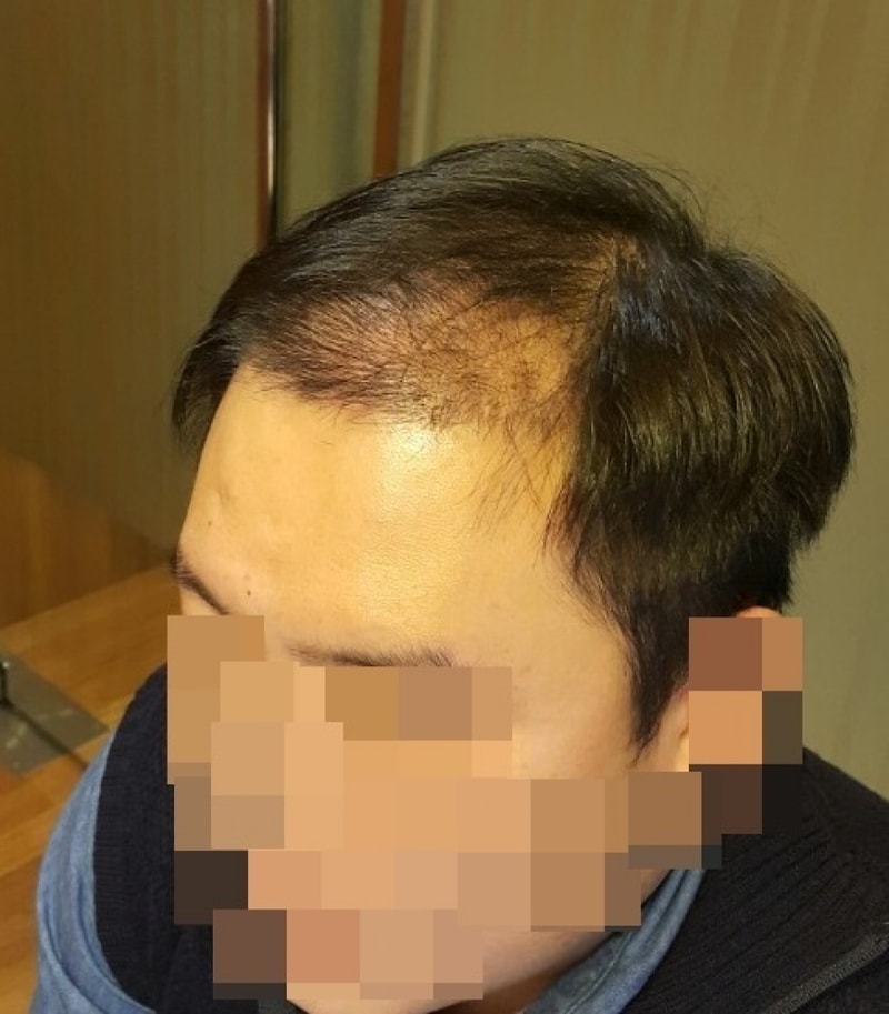 수술후2.jpg