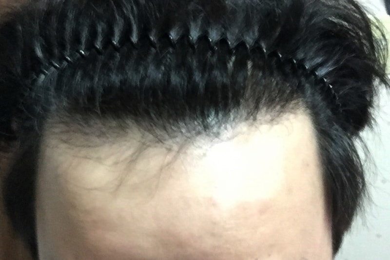 151221 이동길1.jpg