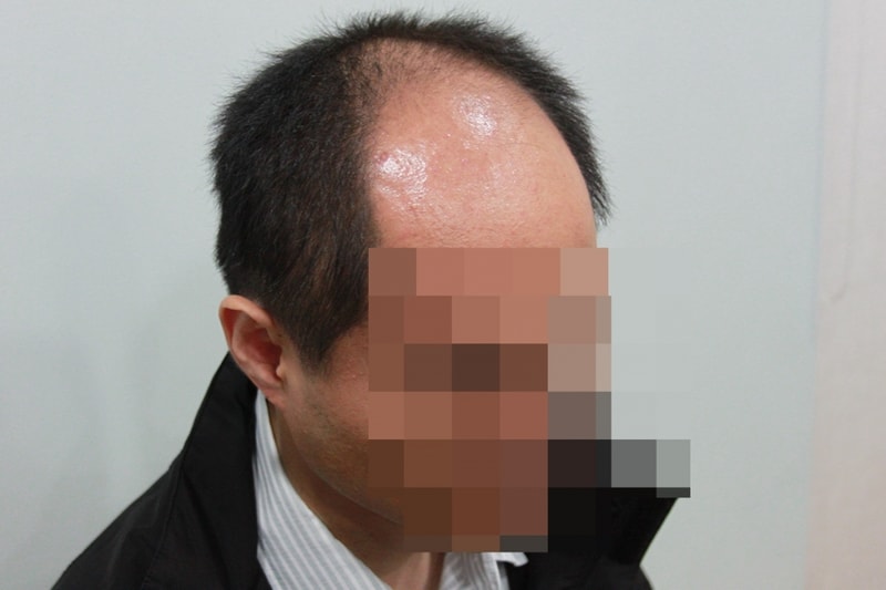 수술전_1.jpg