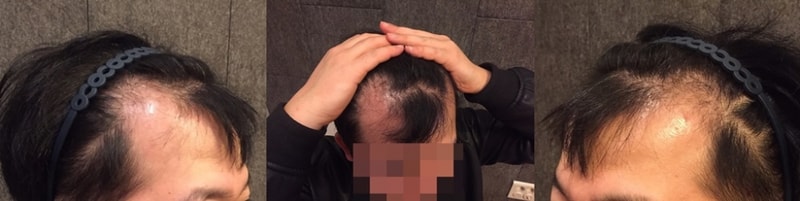 전.jpg