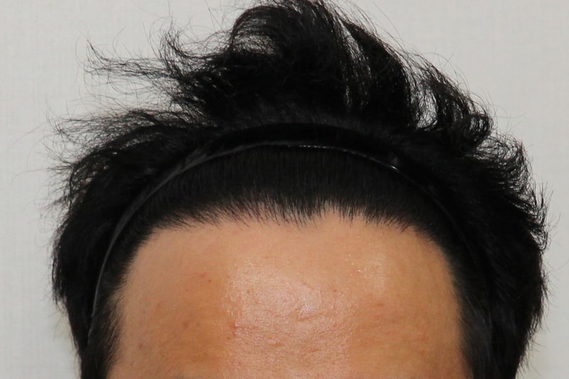 후3.jpg