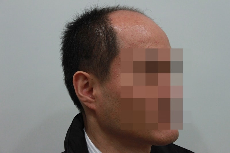 수술전.jpg