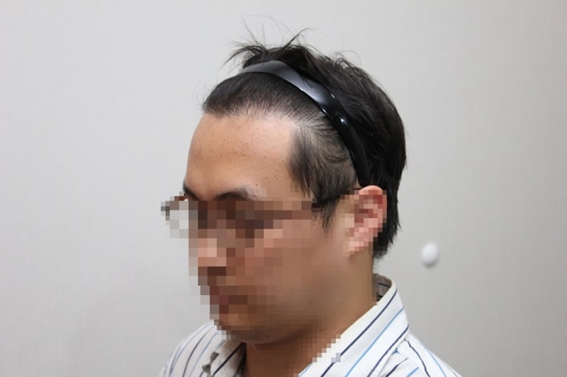 18개월_3.JPG