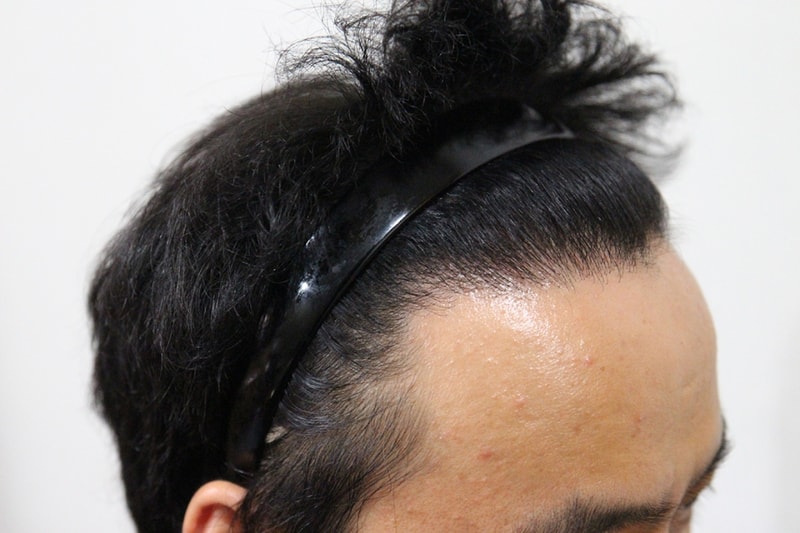 후1.jpg