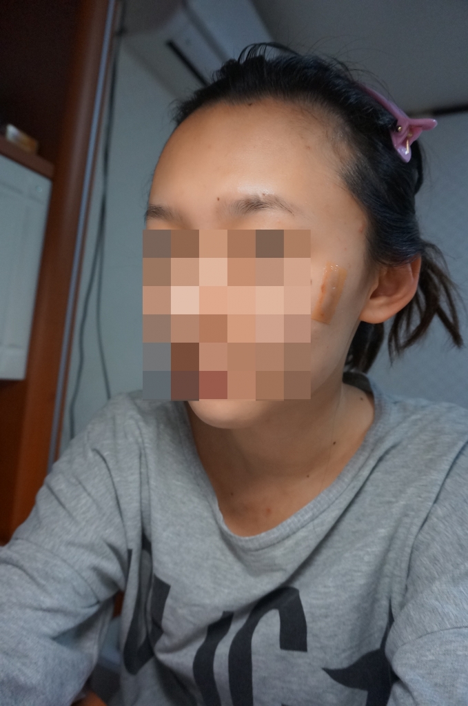 헤어라인 예쁘게 내리고 싶다면 강추ㅋㅋ