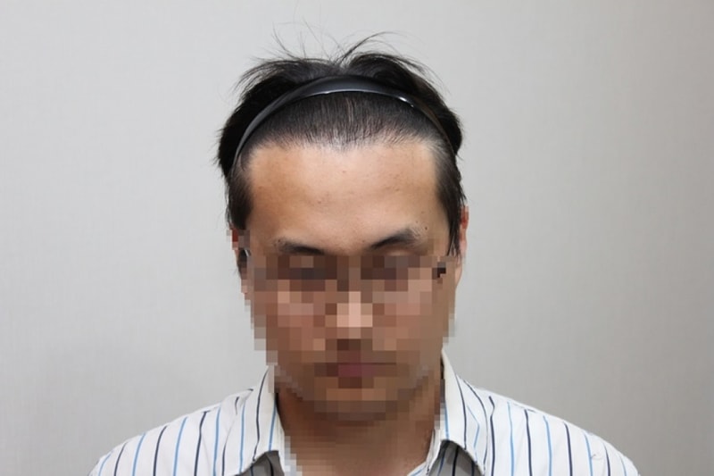 18개월_2.JPG