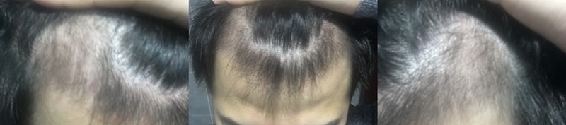 암흑기.jpg