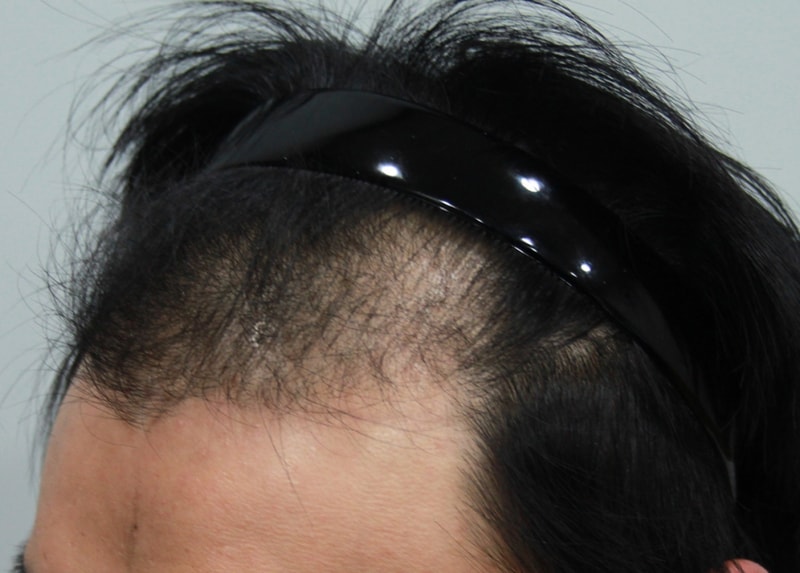 before.JPG