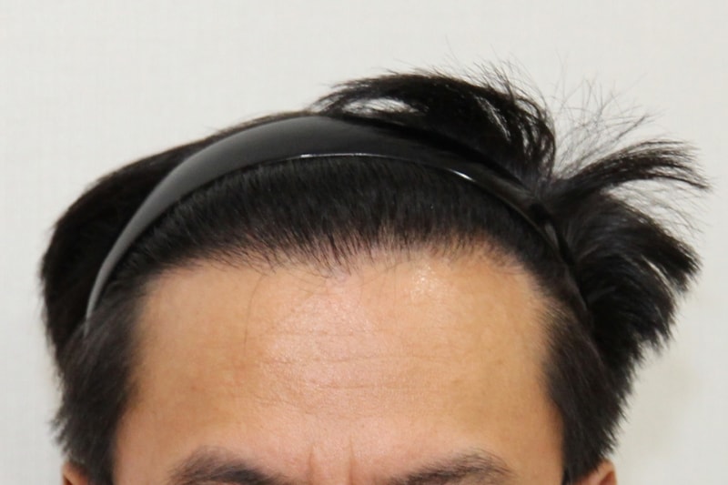 후 (1).JPG