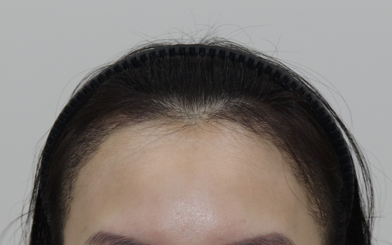 A70CF162-8CB6-47A0-B782-17E71B4DDD81.jpeg